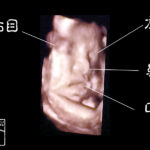妊婦健診　胎児のエコー3D写真