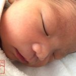 新生児の鼻にある白い点々