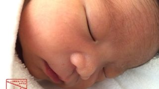 新生児の鼻にある白い点々